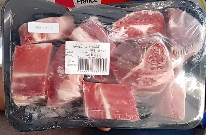 كتف برازيلي